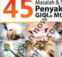 Image of 45 Masalah & solusi penyakit gigi & Mulut