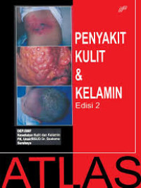 Image of Penyakit kuli dan kelamin