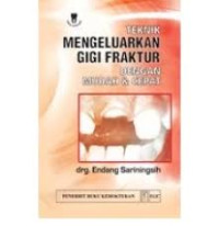 Image of TEKNIK MENGELUARKAN GIGI FRAKTUR DENGAN MUDAH DAN CEPAT